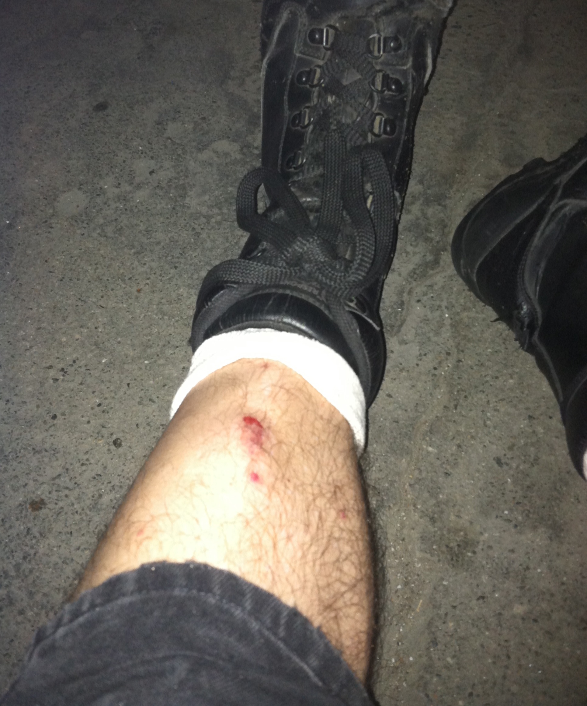 Shins Bruised During Extreme High Tide in Long Beach - Random